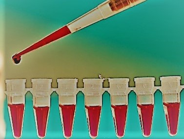Blood screening